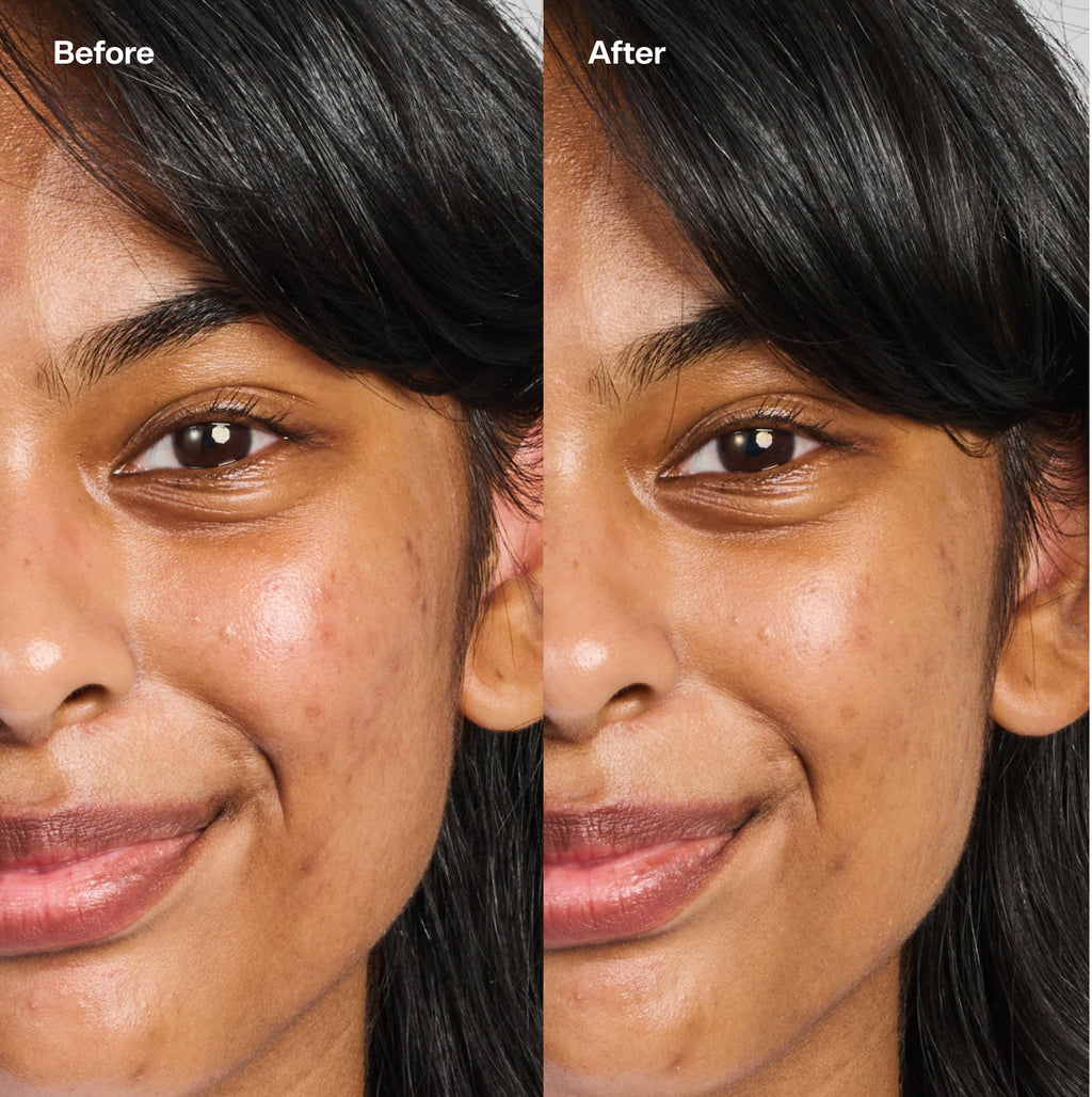Bubble Skincare Under Cover